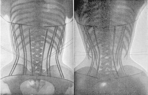 danger waist training